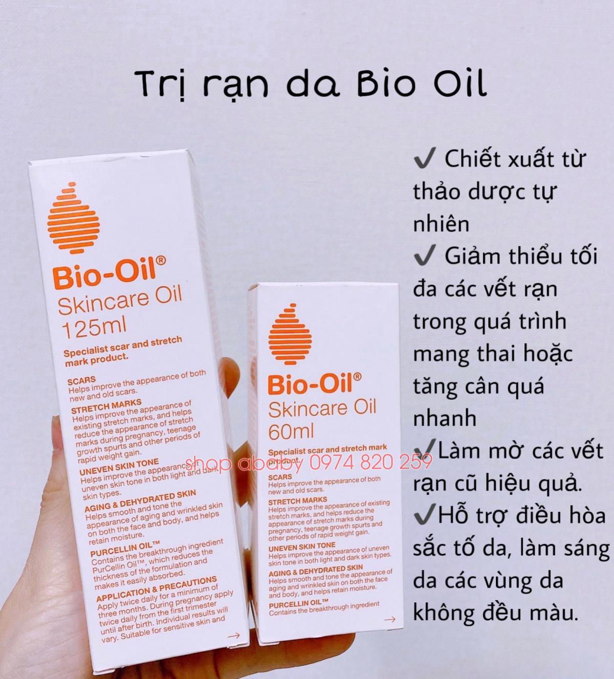 Trị rạn da Bio Oil